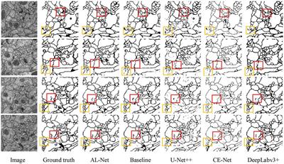 AL-Net: Asymmetric Lightweight Network for Medical Image Segmentation